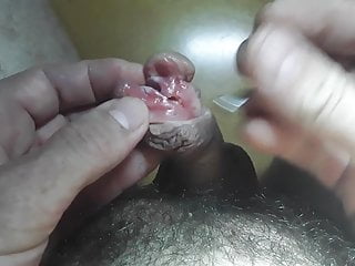 Sharp with the addition of subincision
